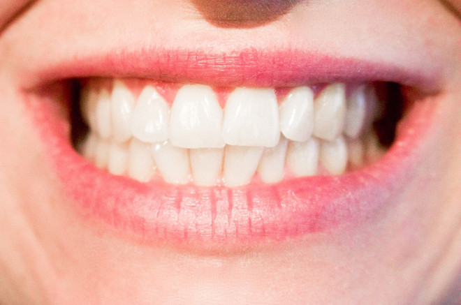 fluoer je sastojak zubne cakline